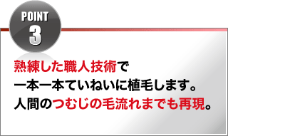 POINT3 熟練した職人技術で一本一本ていねいに植毛。人間のつむじの毛流れも再現。