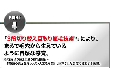 POINT4 「3段切り替え目取り植毛技術※」により、まるで毛穴から生えているような自然感。※「3段切り替え目取り植毛技術」…3種類の長さを持つ人毛・人工毛を使い、計算された間隔で植毛する技術。